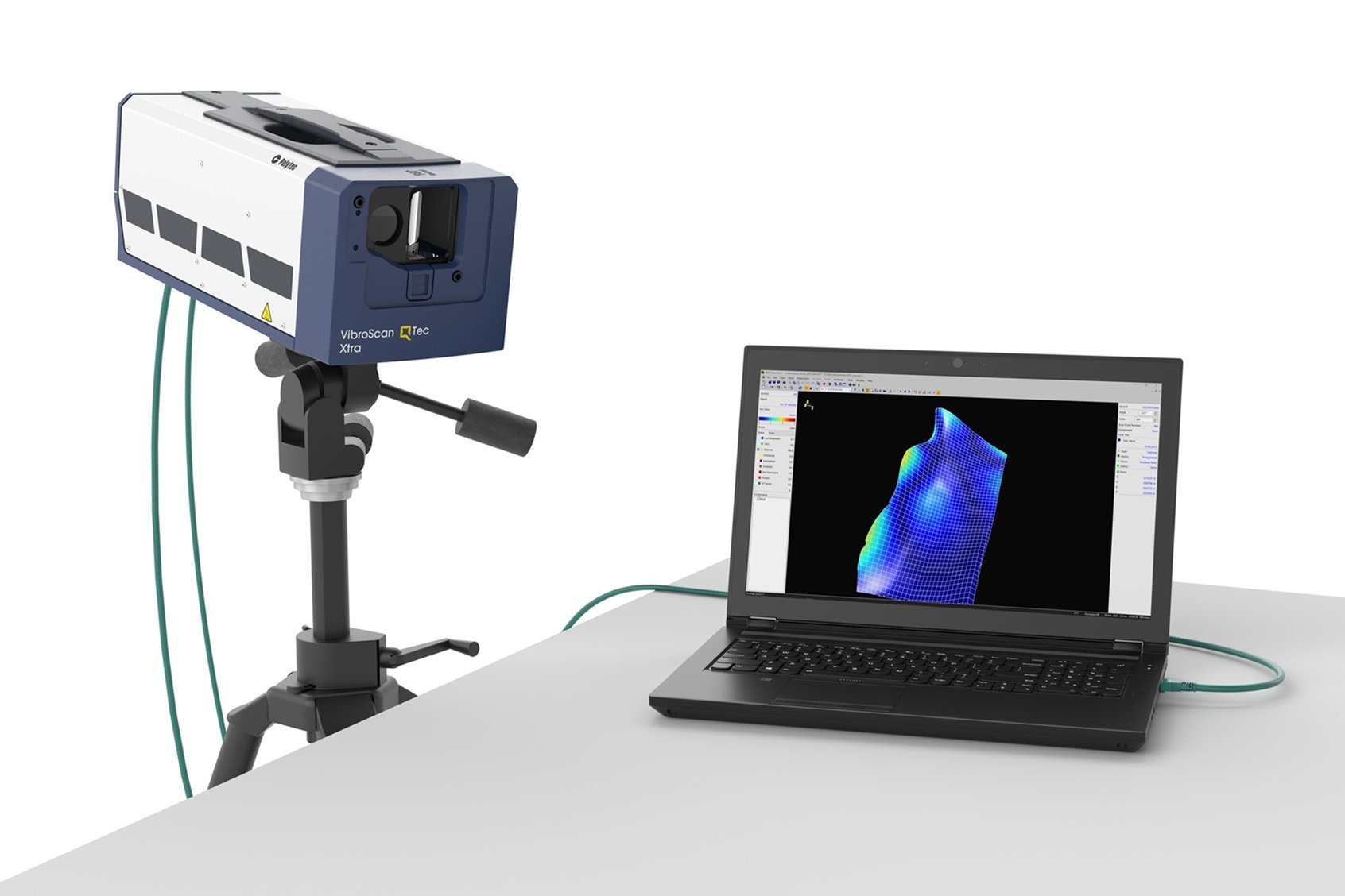 VibroScan QTec Xtra with laptop and PSV Software VibroScan QTec Xtra with laptop and PSV Software
