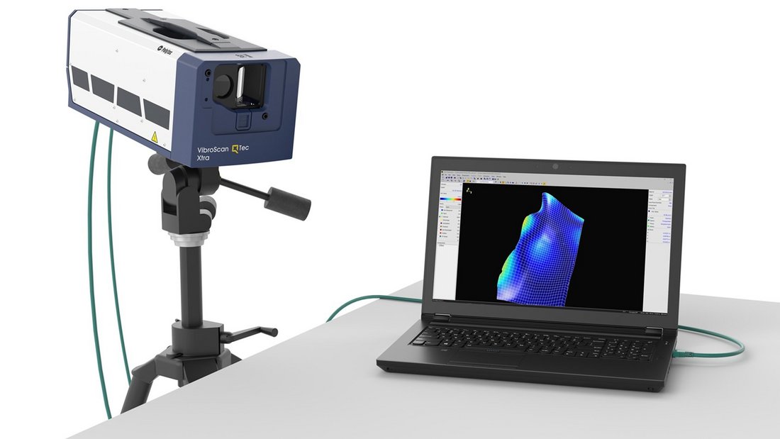VibroScan QTec Xtra with laptop and PSV Software VibroScan QTec Xtra with laptop and PSV Software